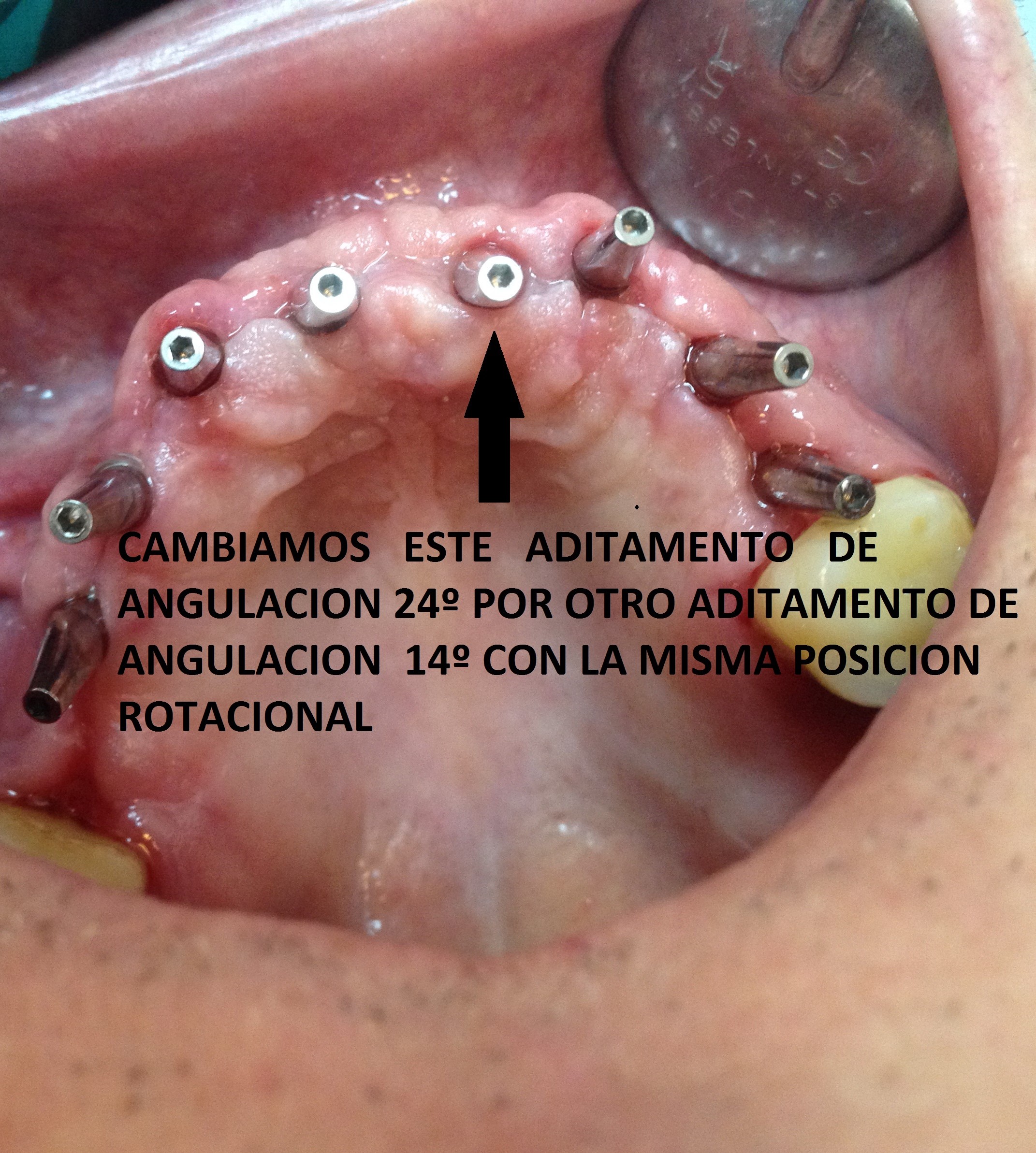 5COPIA